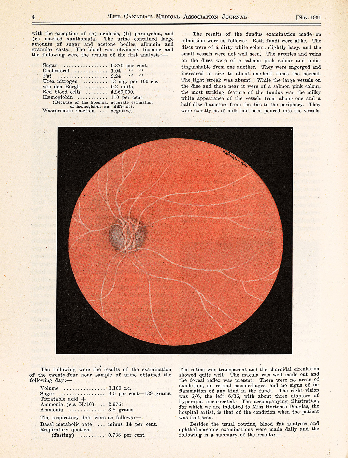 journal page with drawing of eye fundus